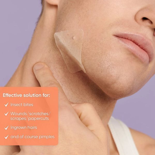 Plasturi acneici SkinChoice Classic XL, 10 plasturi puternici pentru acnee