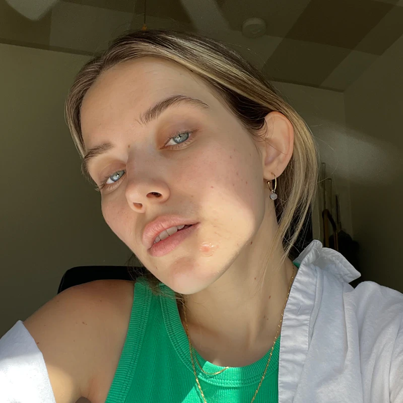 Hero Cosmetics Mighty Patch Adesivo invisível para acne