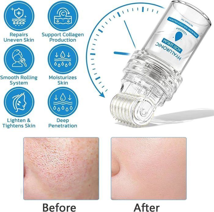 Sistema de microinfusión para tratamientos faciales y labiales, ácido hialurónico, rodillo de microinfusión Microdart, sistema facial con sérum.
