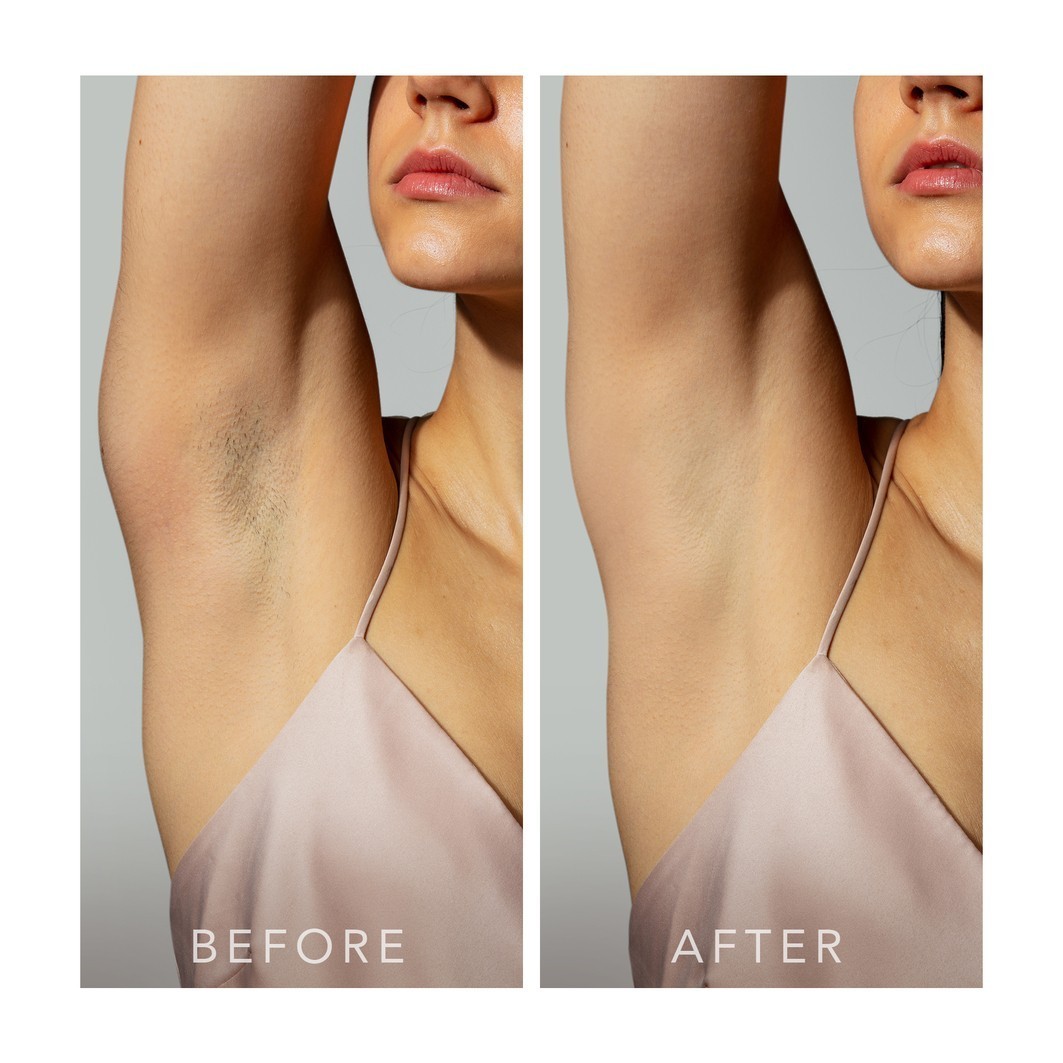 FOREO epiliatorius PEACH™ 2 - 1 vnt.
