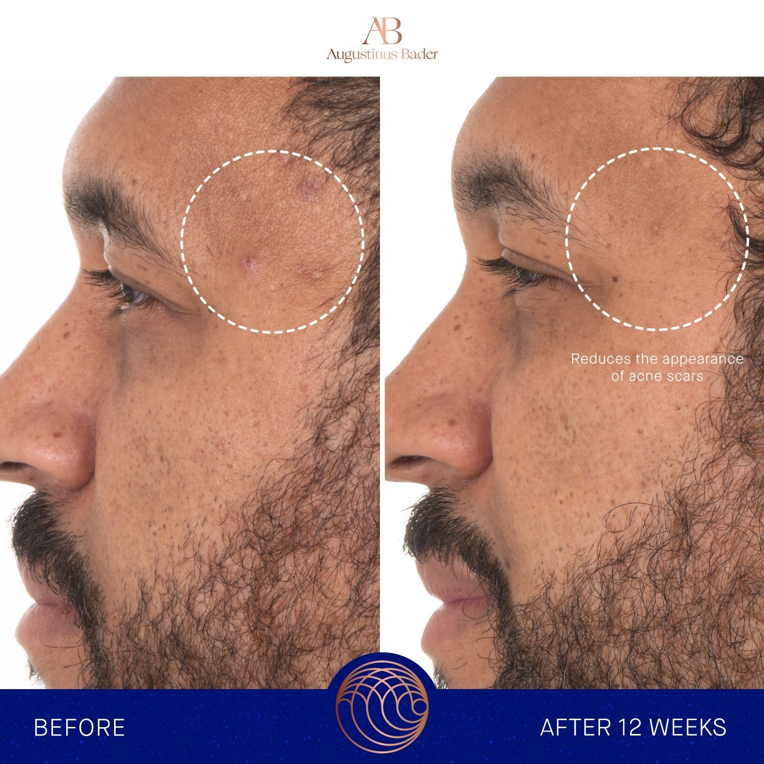 Augustinus Bader mitrinošais serums RETINOL SERUM - 30 ml