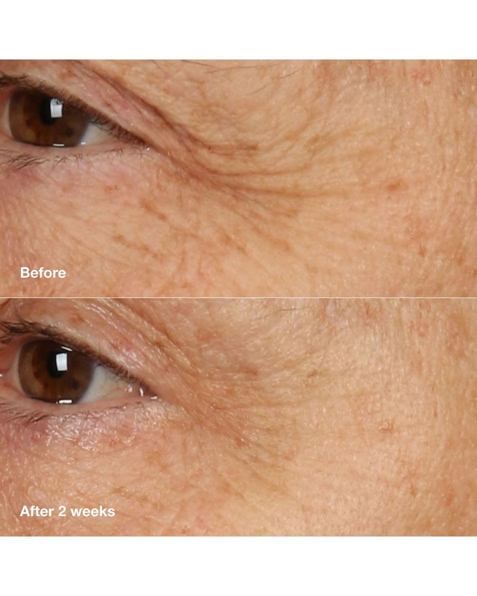 Mască cremă de recuperare nocturnă CLINIQUE Smart Clinical Repair™ Cremă anti-îmbătrânire