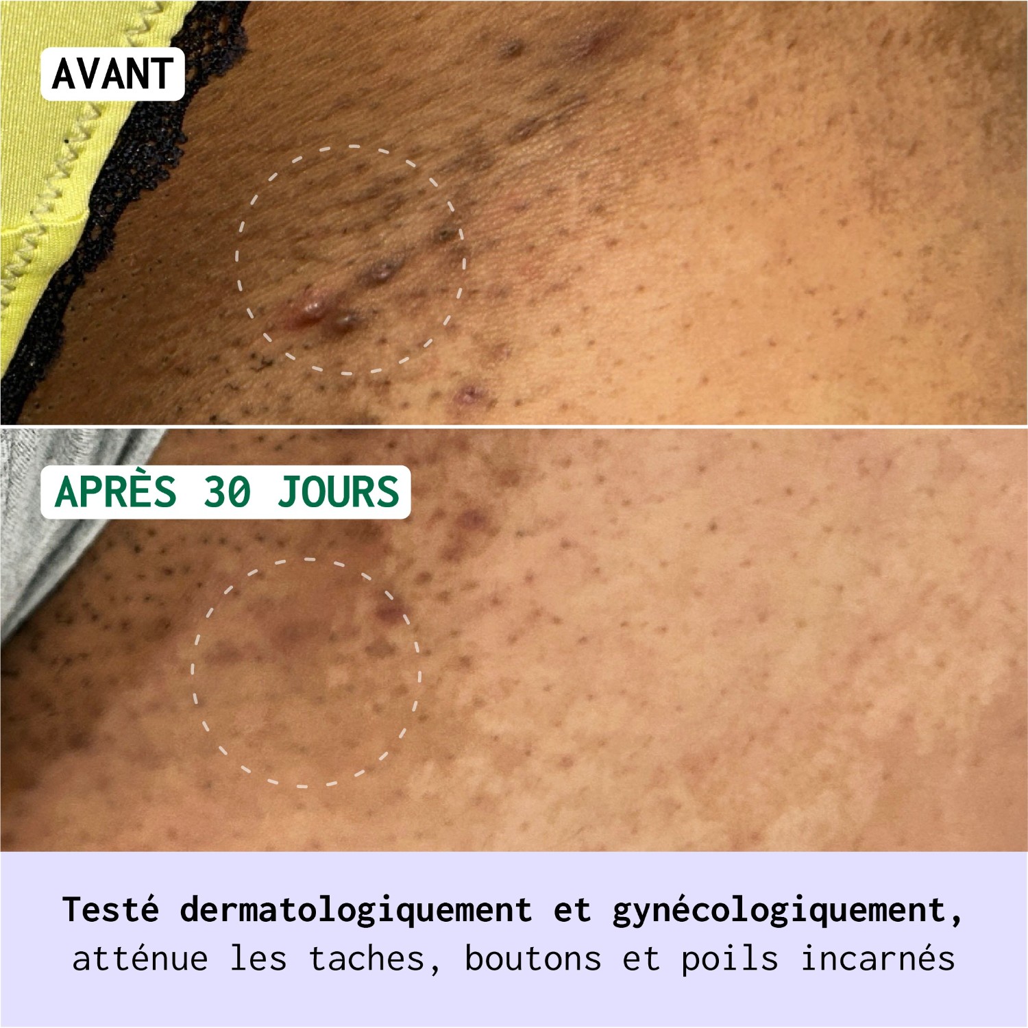 Nubiance Melintim® - Crème Multi-réconfortante Zones Intimes Externes