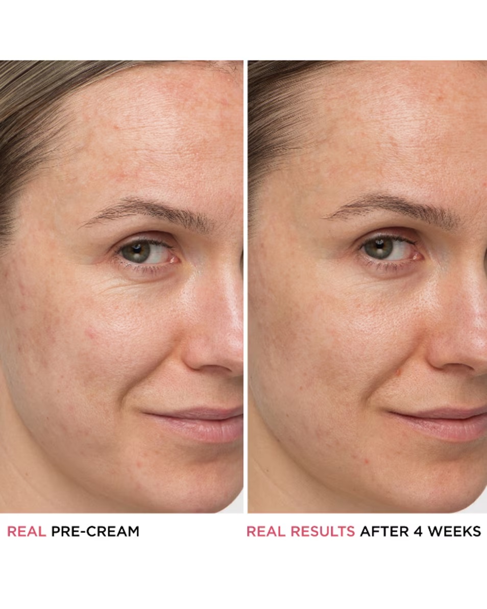 IT COSMETICS ΕΜΠΙΣΤΟΣΥΝΗ ΣΕ ΜΙΑ ΕΝΥΔΑΤΙΚΗ ΚΡΕΜΑ CREAM™