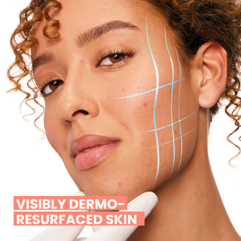 Avène Cleanance Comedomed Sérum Intensivo Contra Imperfeições da Pele com Tendência à Acne