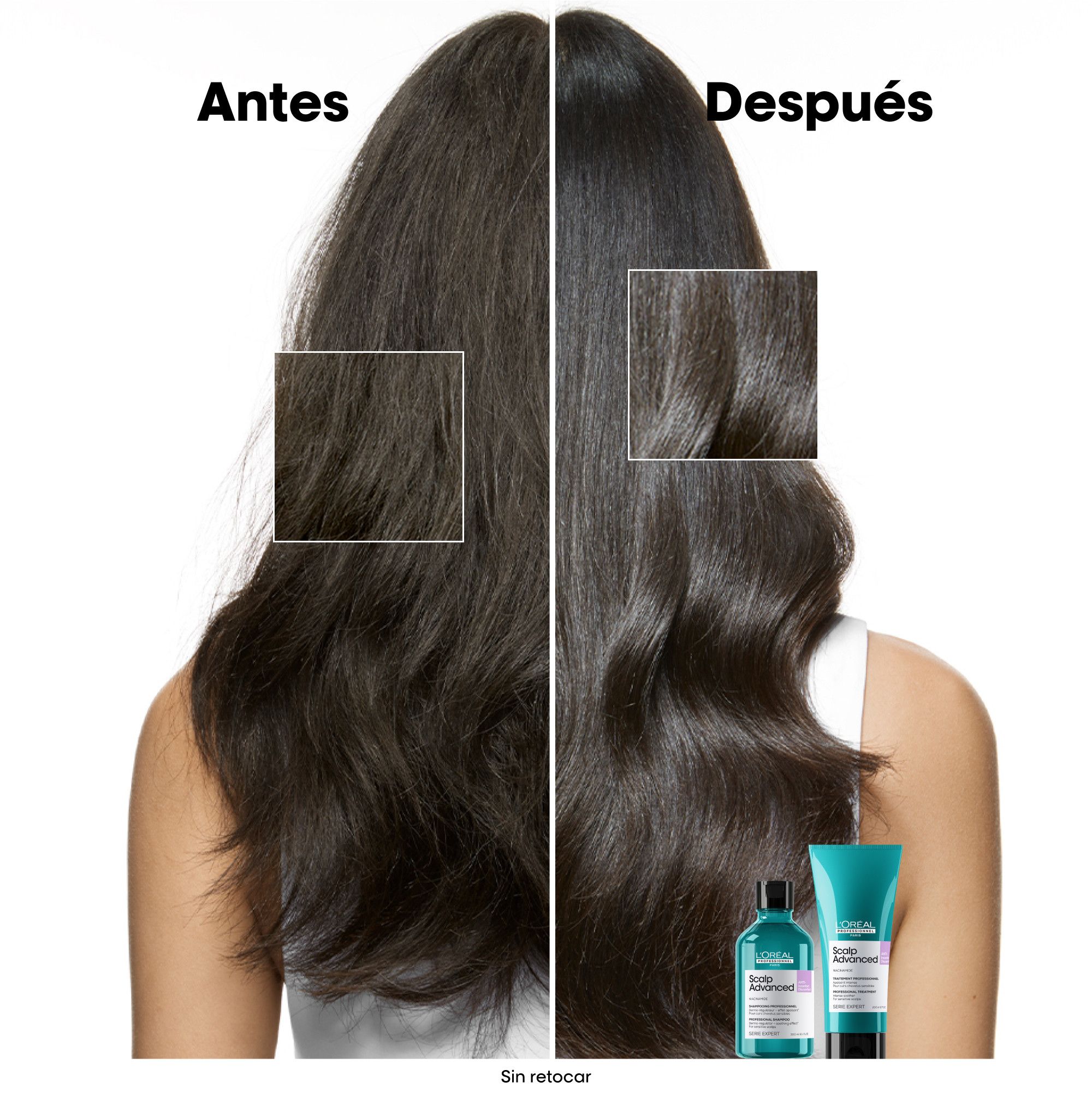 Serie Expert Scalp Advanced Dermo-Regulating šampon, dopuna Šamponi za salone
