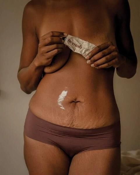 Crema rivitalizzante anti-smagliature Nemah