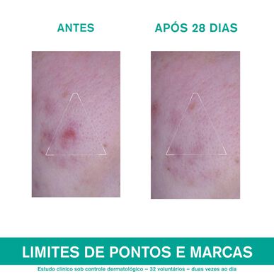 Uriage Hyséac 3-Regul Soin Global Anti-ufullkommenhetskrem for akneutsatt hud 40 ml
