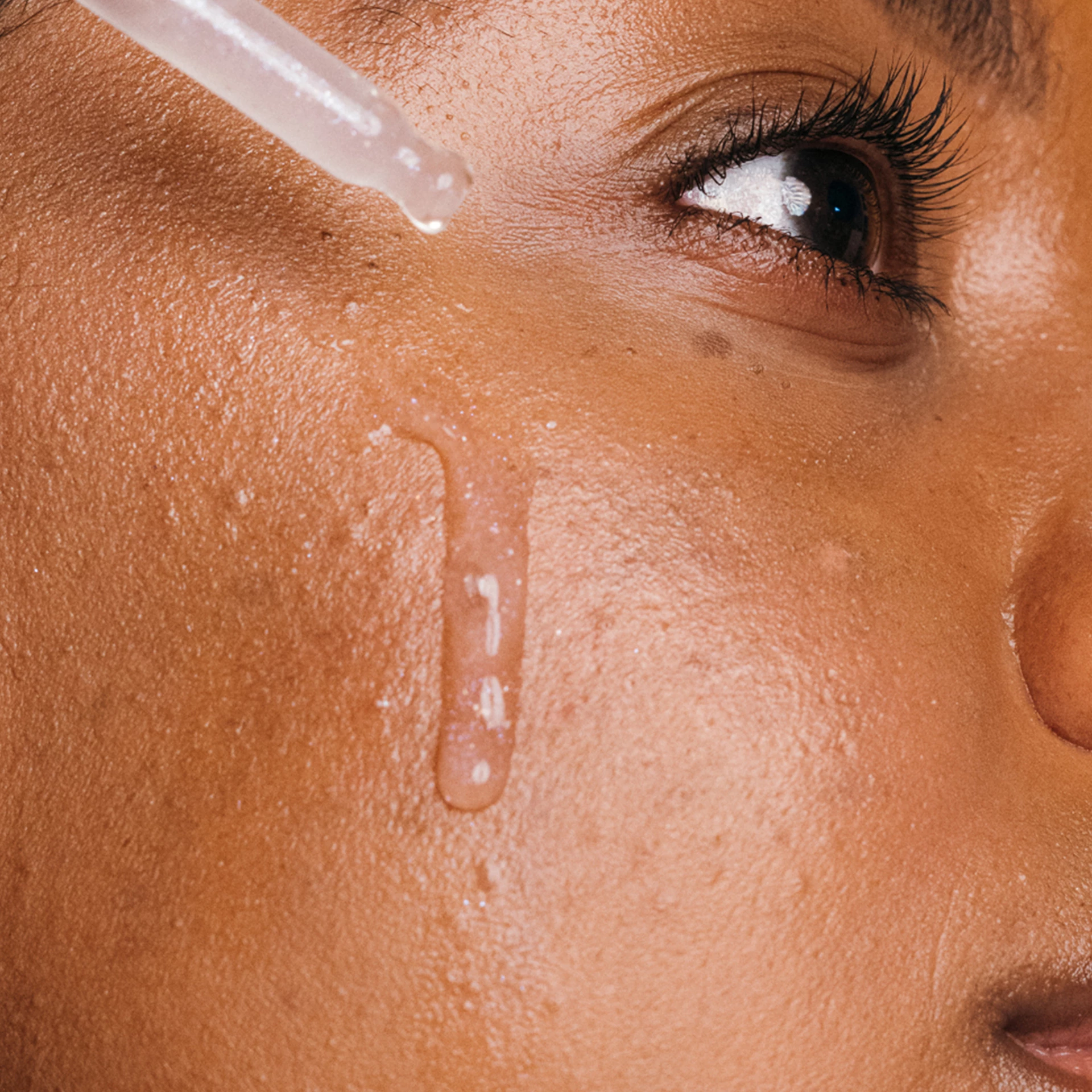 Pattanástisztító folyékony hámlasztó 30 ml - Dermalogica