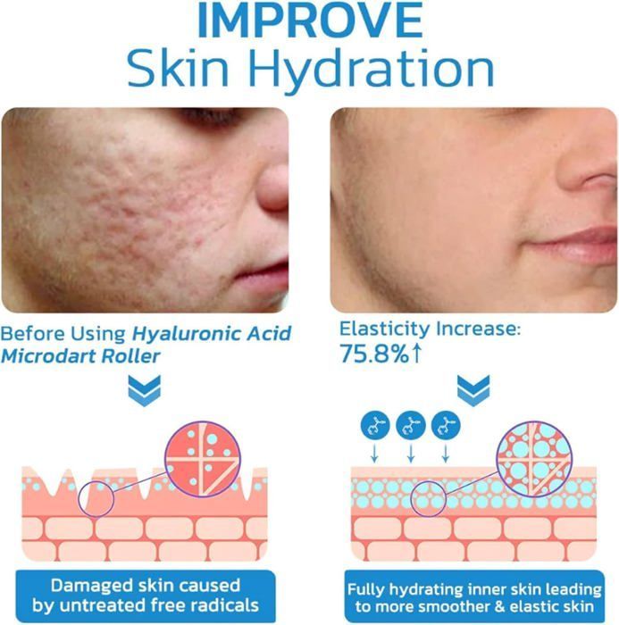 Sistema de microinfusión para tratamientos faciales y labiales, ácido hialurónico, rodillo de microinfusión Microdart, sistema facial con sérum.