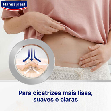 Hansaplast XL flasteri za smanjenje ožiljaka 21 komad