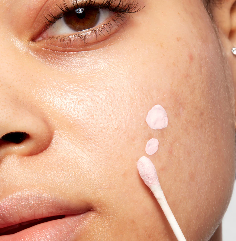 Loção Secativa Anti-Acne Mario Badescu