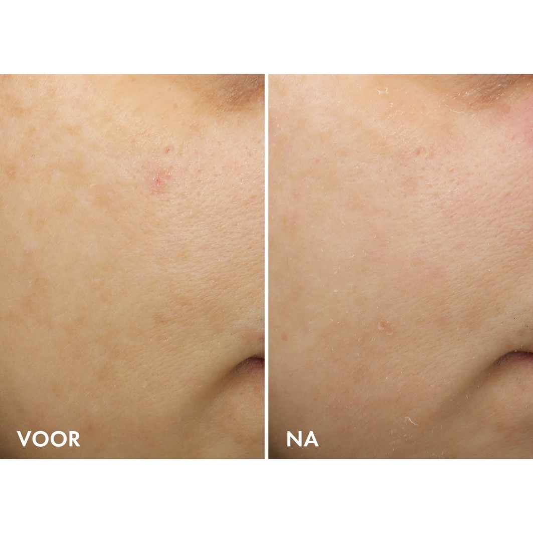 „Vichy Liftactiv Pigment Specialist B3“ naktinis kremas su grynu retinoliu – 50 ml