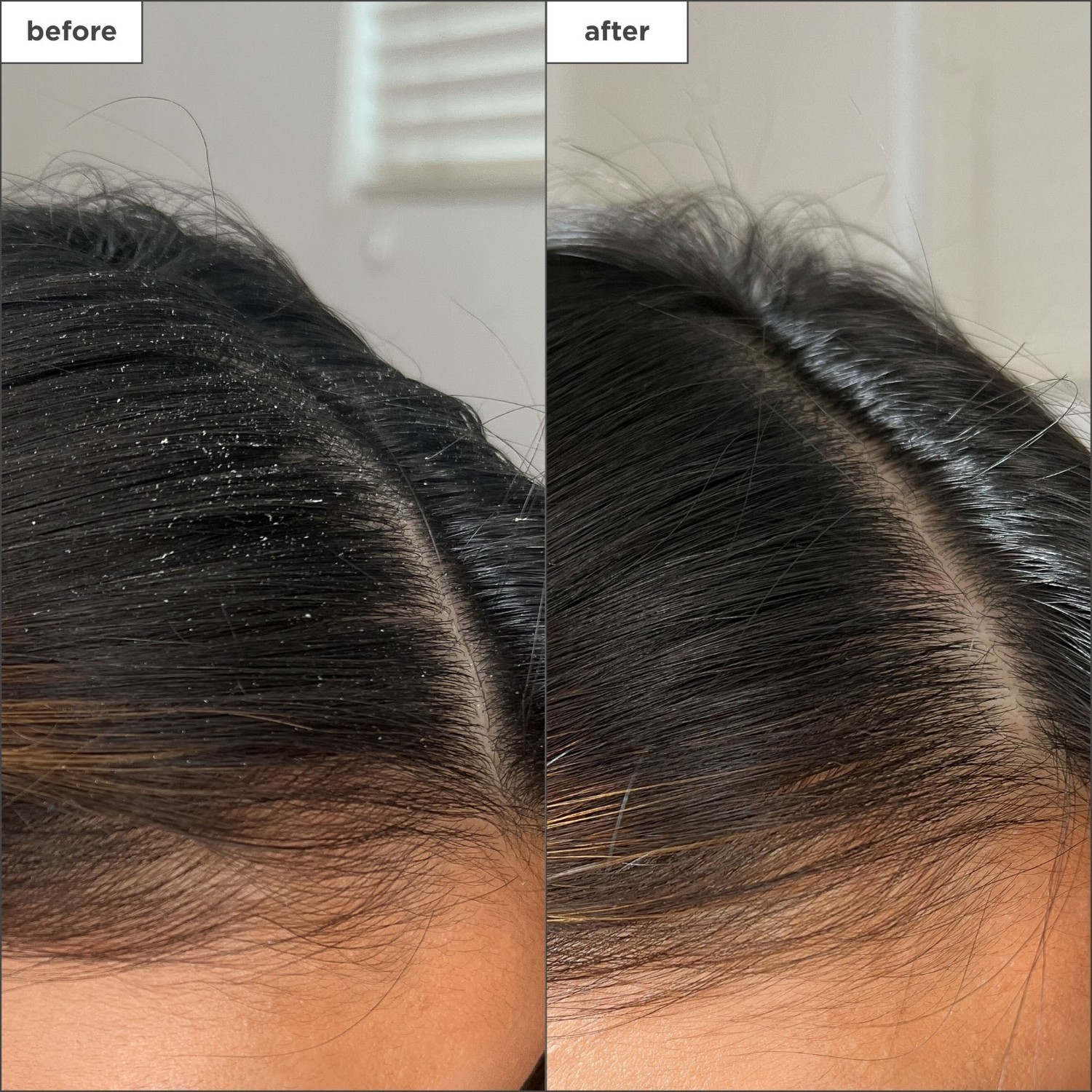 Briogeo Hair Fluid Scalp Revival™ Detoxikačný sprej s aktívnym uhlím a olejom z čajovníka - 120 ml