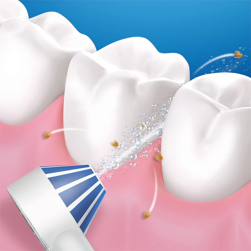Zubný irigátor Oral-B Aquacare 4