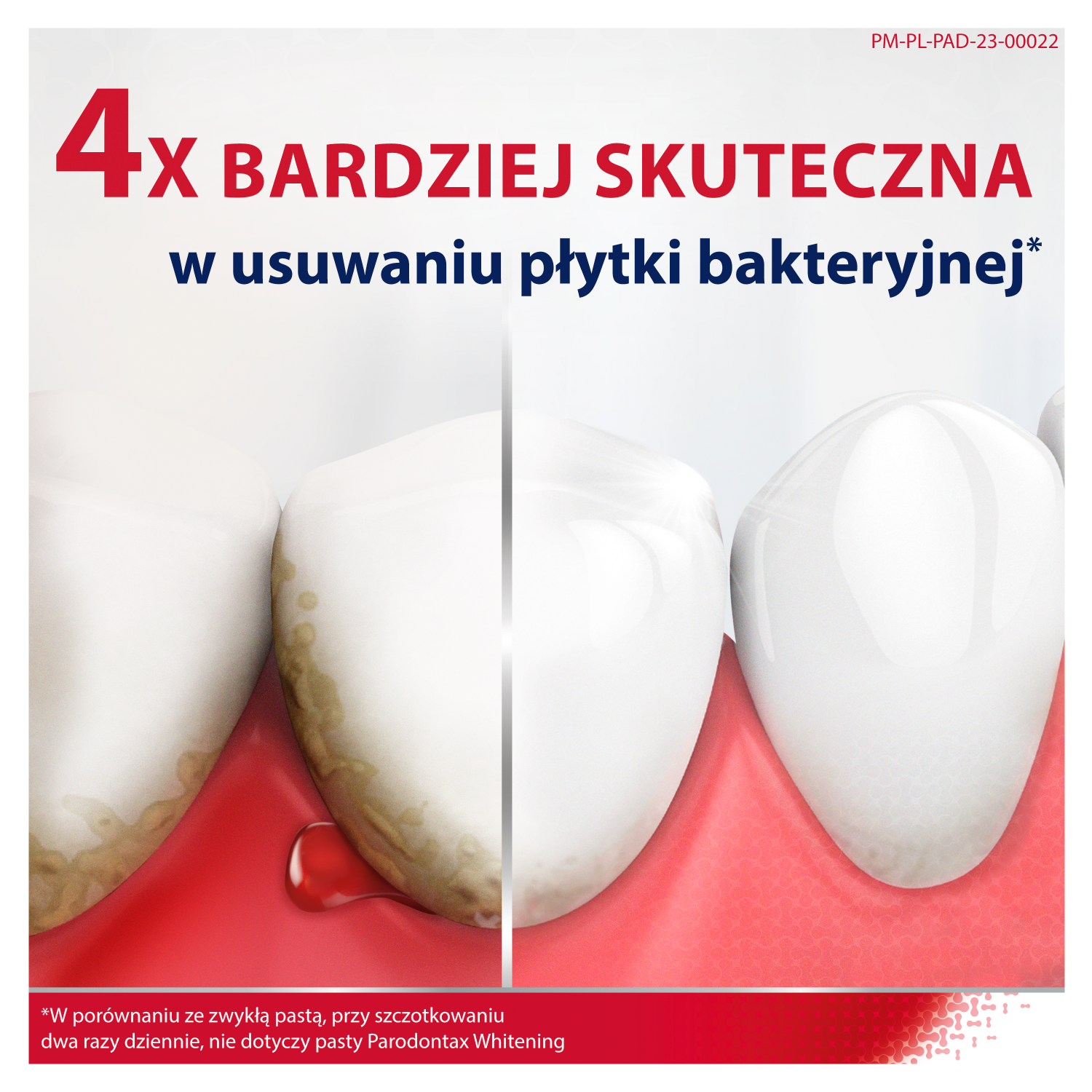 Pastă de dinți Parodontax cu fluorură 75ml