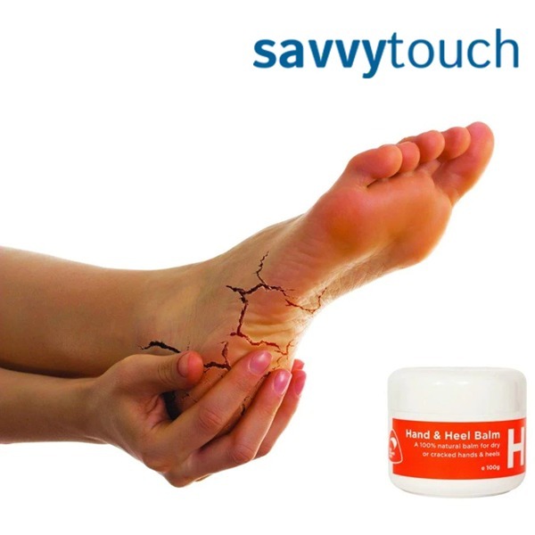 Savvy Touch balzám na ruce a paty pro suchou a popraskanou pokožku 100 g