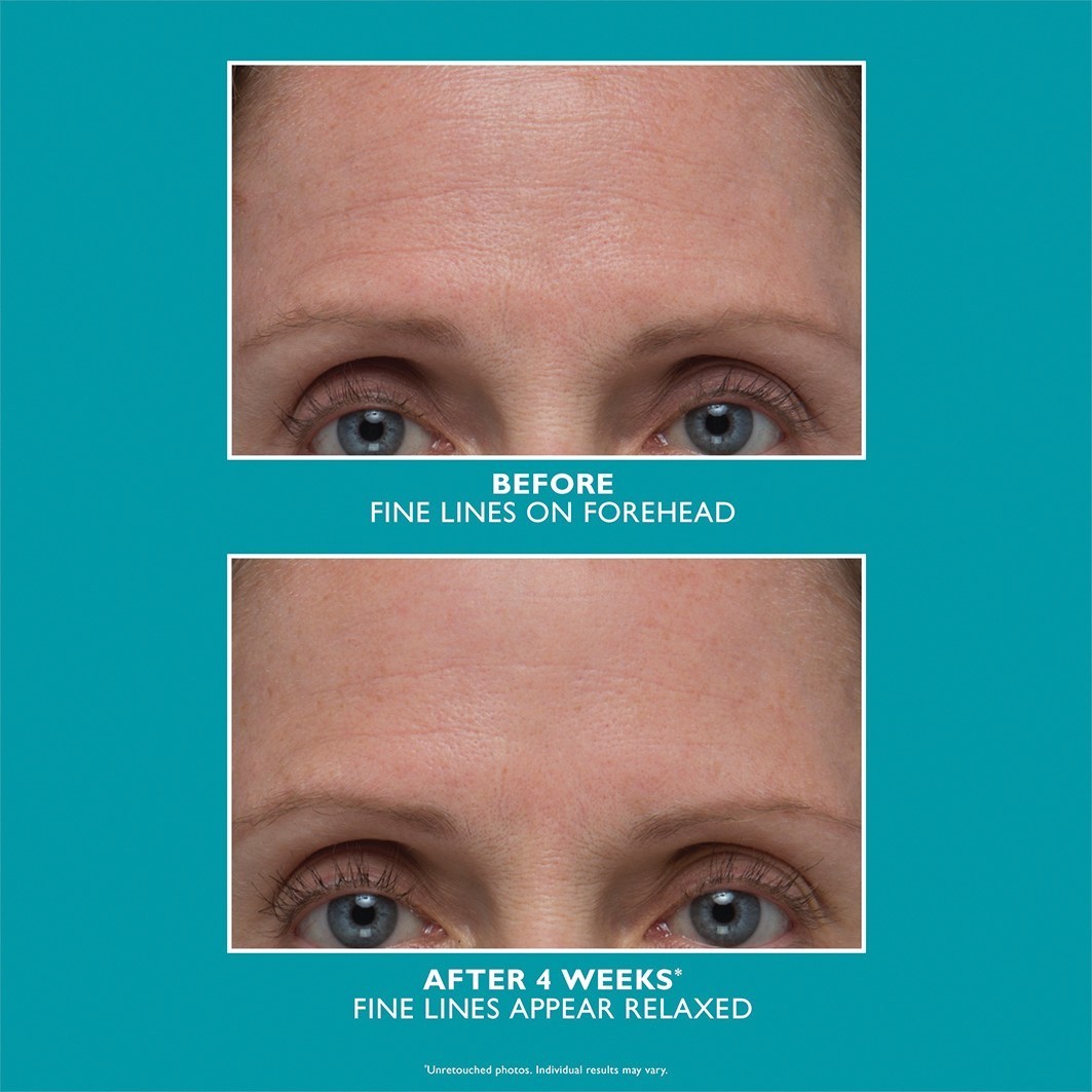 Peter Thomas Roth Anti-Aging-Serum Peptide Skinjection™ pojačani serum za učvršćivanje bora – 30 ml