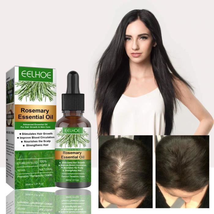 Aceite esencial de romero para el cuidado del cabello: previene la rotura y favorece el crecimiento del cabello.