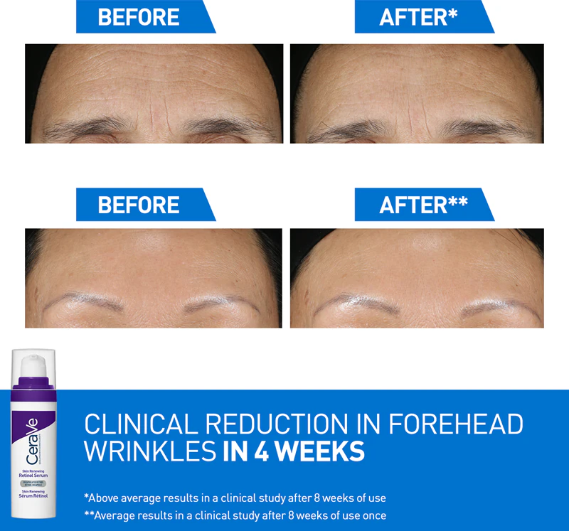 CeraVe Skin Renewing Retinol Serum: sérum antirrugas com retinol que renova a barreira protetora da pele.