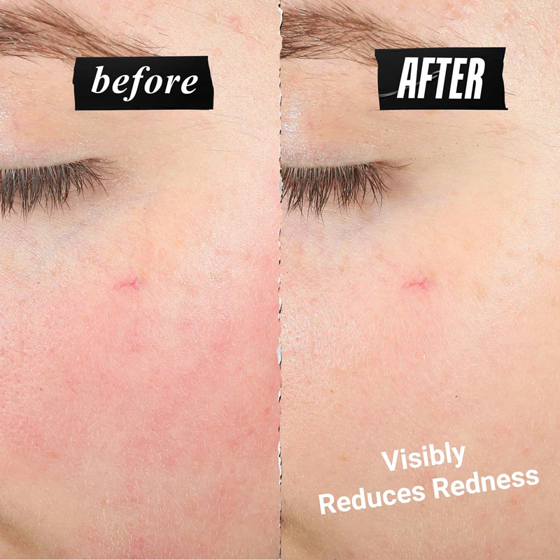 Creme de recuperação facial Ultra Facial Meltdown da Kiehl's