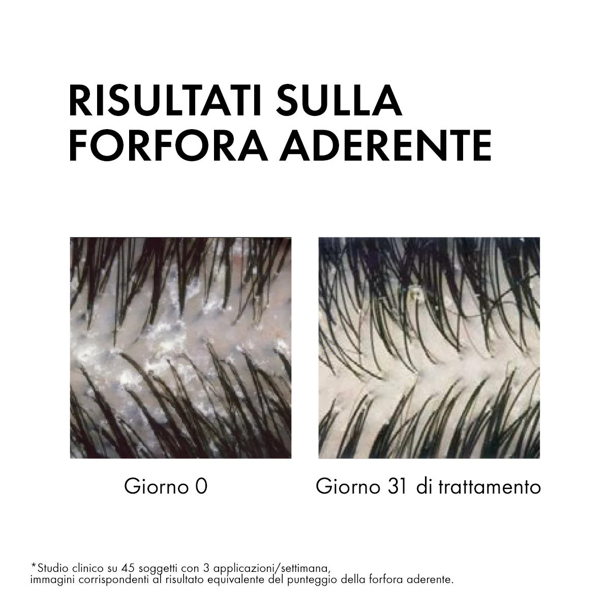 Dercos DT Shampoo Antiforfora DS capelli da normali a grassi - Shampoo Antiforfora