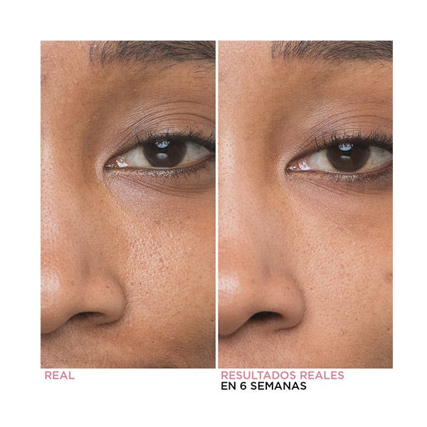 Ορός γλυκολικού οξέος Bye Bye Pores | 30ml