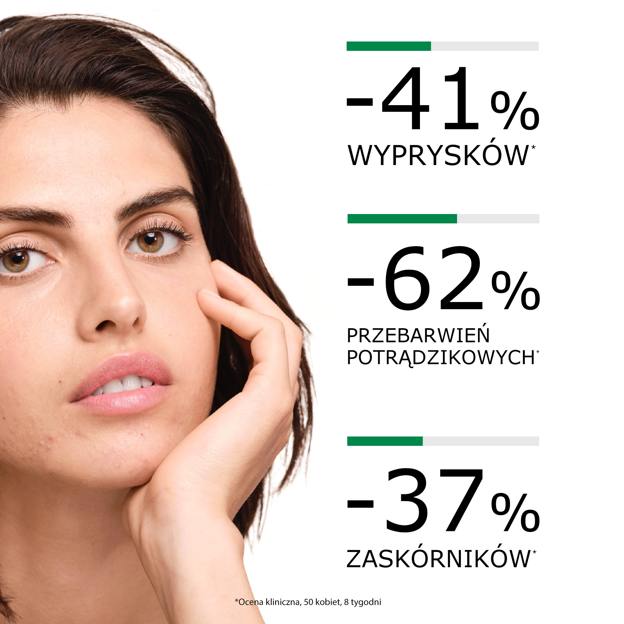 Vichy Normaderm Fitosolucija