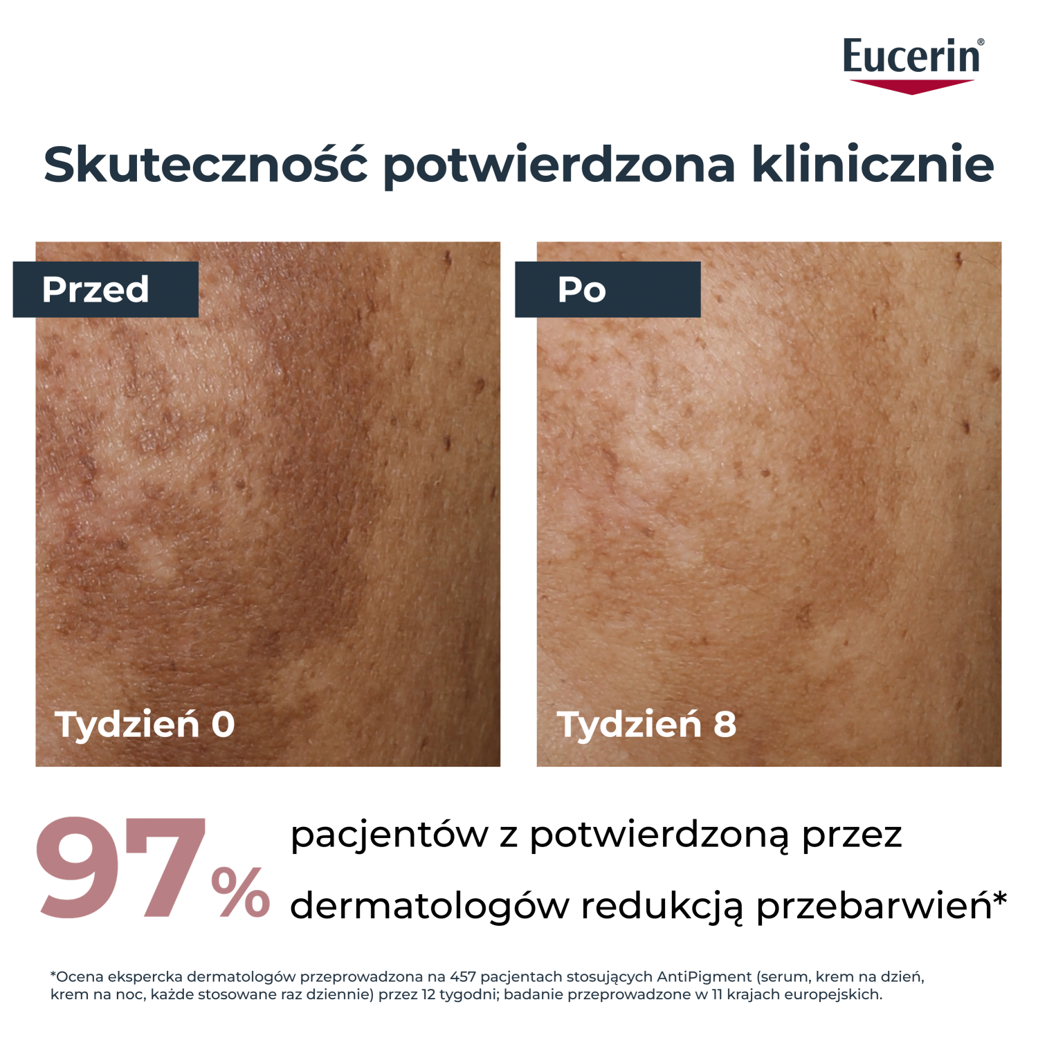 Eucerin Anti-Pigment