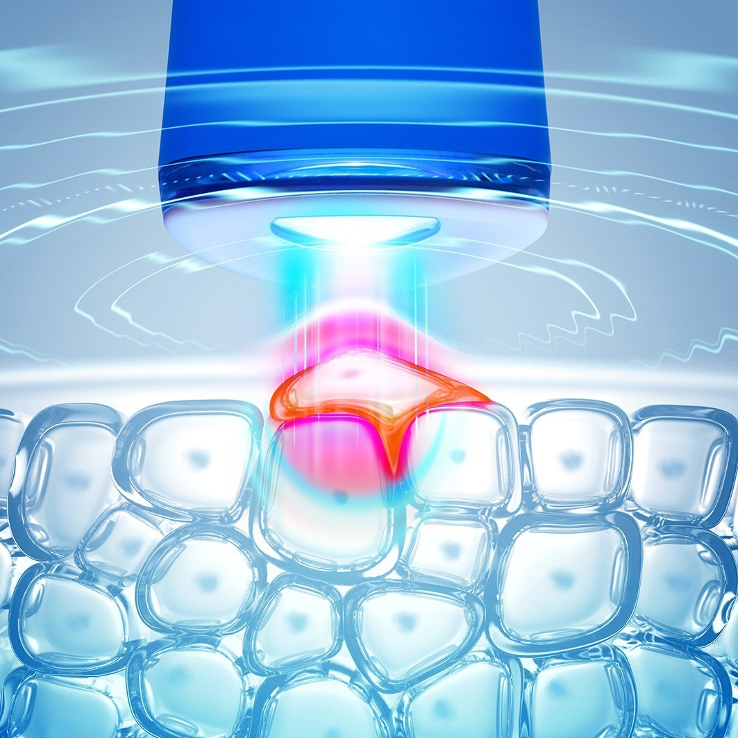 FOREO ESPADA™ 2 Masažer za lice – 1 komad
