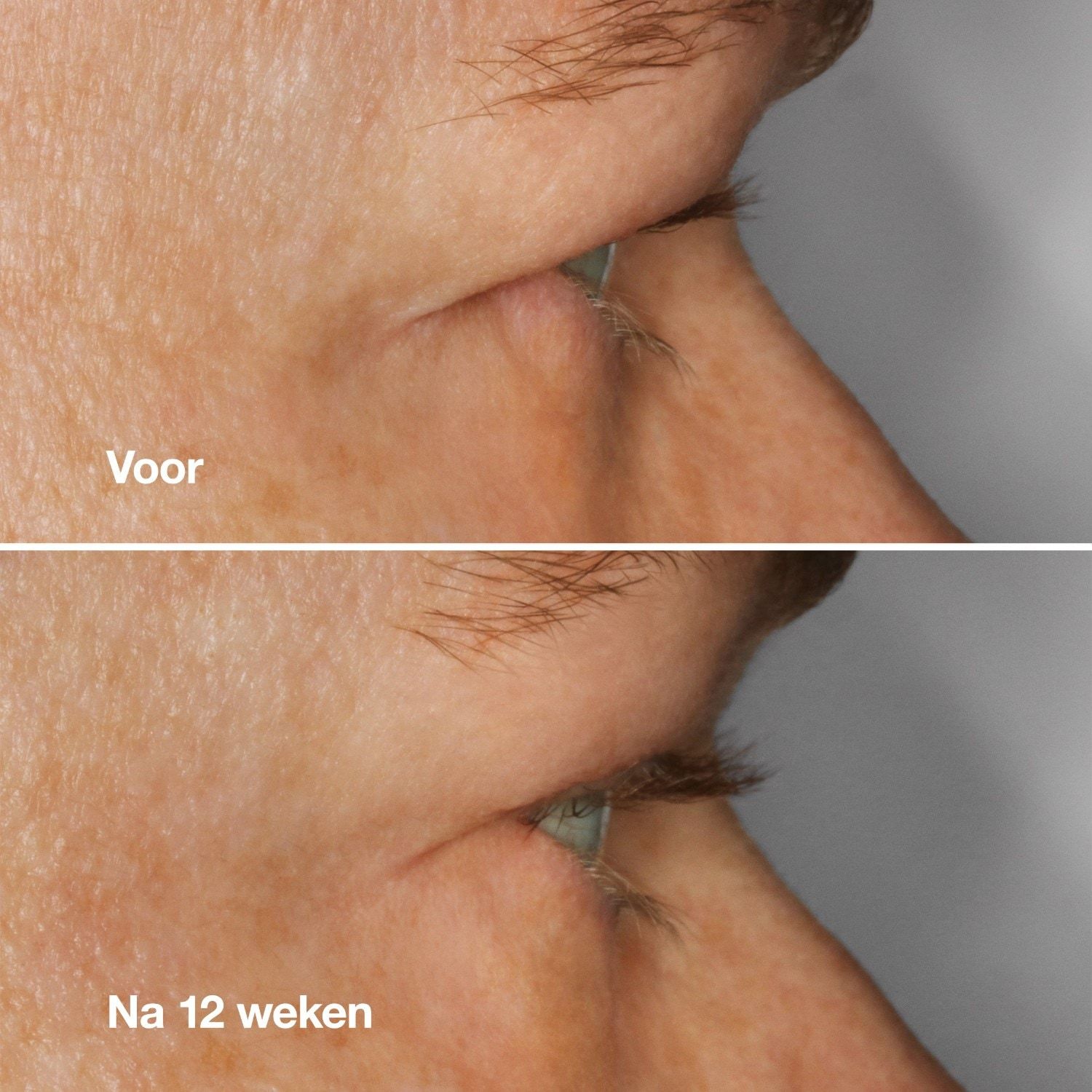 Clinique Wimpernpflege High Impact™ Wimpernserum – 3 ml