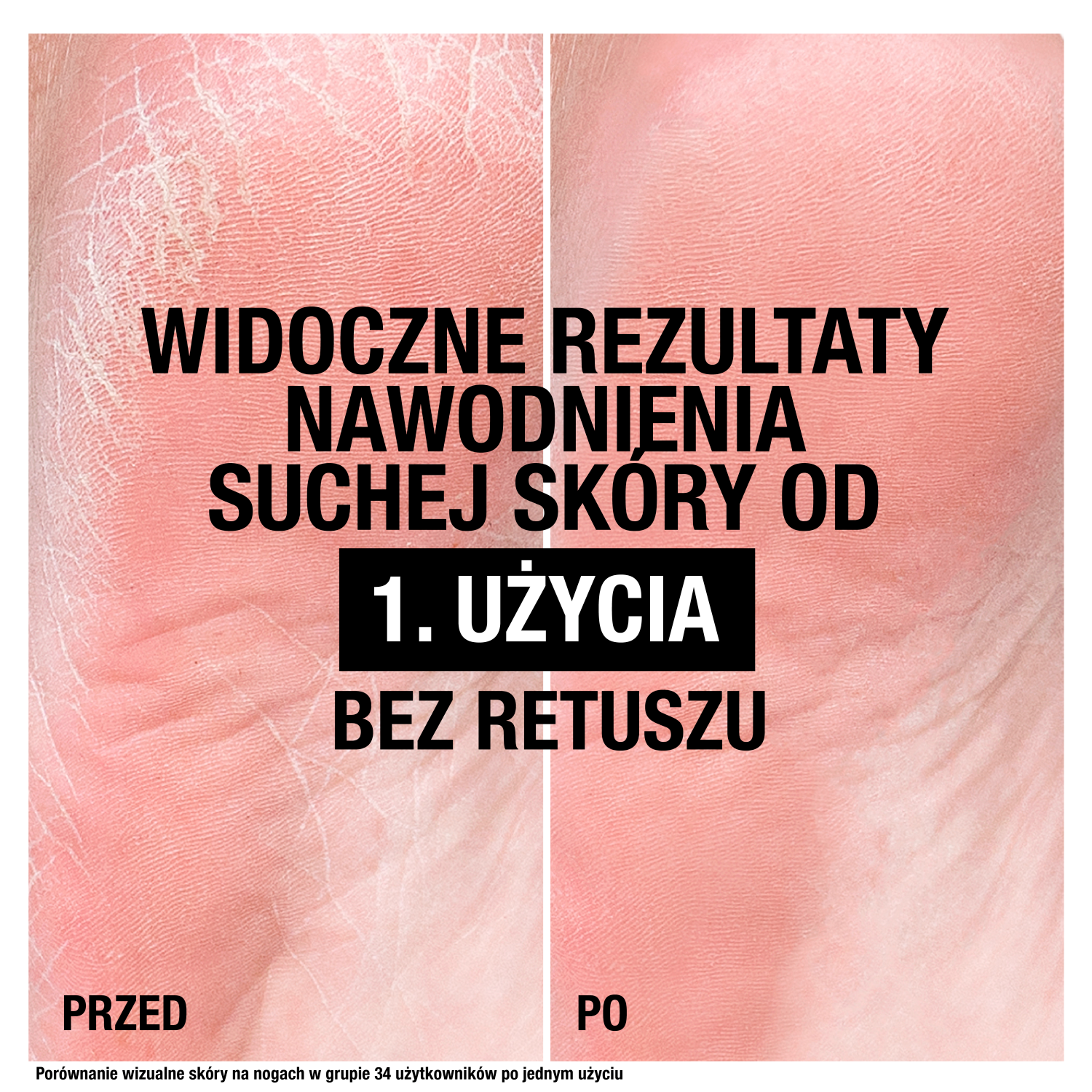 Neutrogena Intensiv Reparation
