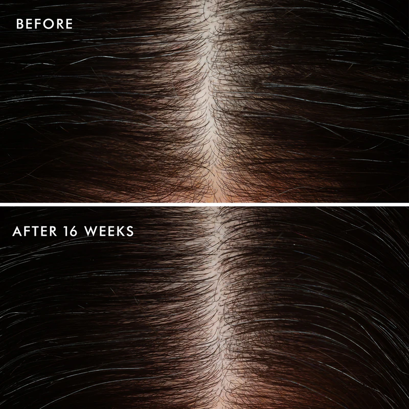 Moroccanoil Scalp Conditioner upokojujúci kondicionér pre mastnú pokožku hlavy