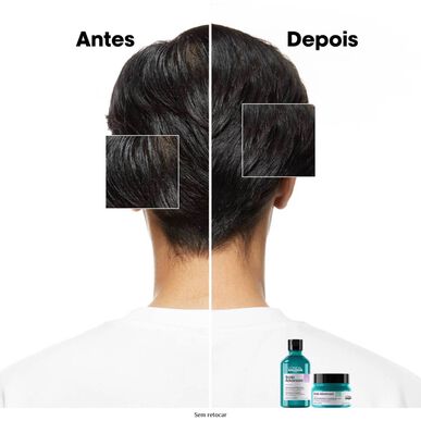 L'Oréal Professionnel Serie Expert Scalp Advanced Anti-Gras Shampoo Rauhoittava Hilsettä Vastustava Shampoo Kuiville Ja Rasvoittuville Hiuksille 500 ml