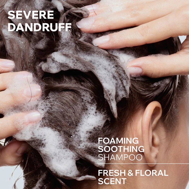 Shampoo de tratamento querato-redutor Uriage DS HAIR para pele sensível e irritada