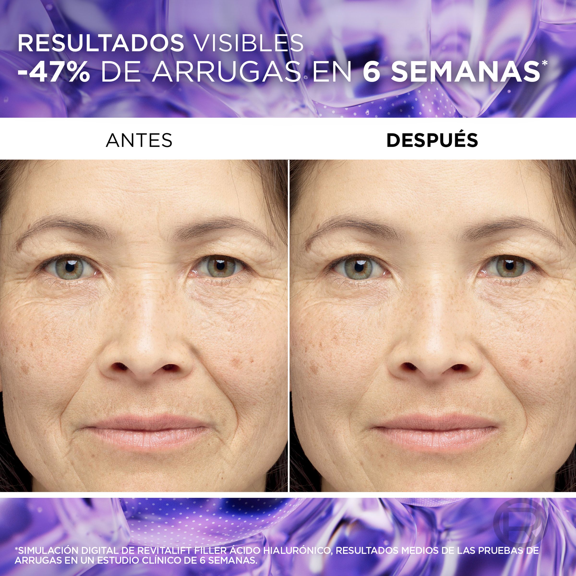 Revitalift Filler serum protiv bora Kreme protiv bora i starenja