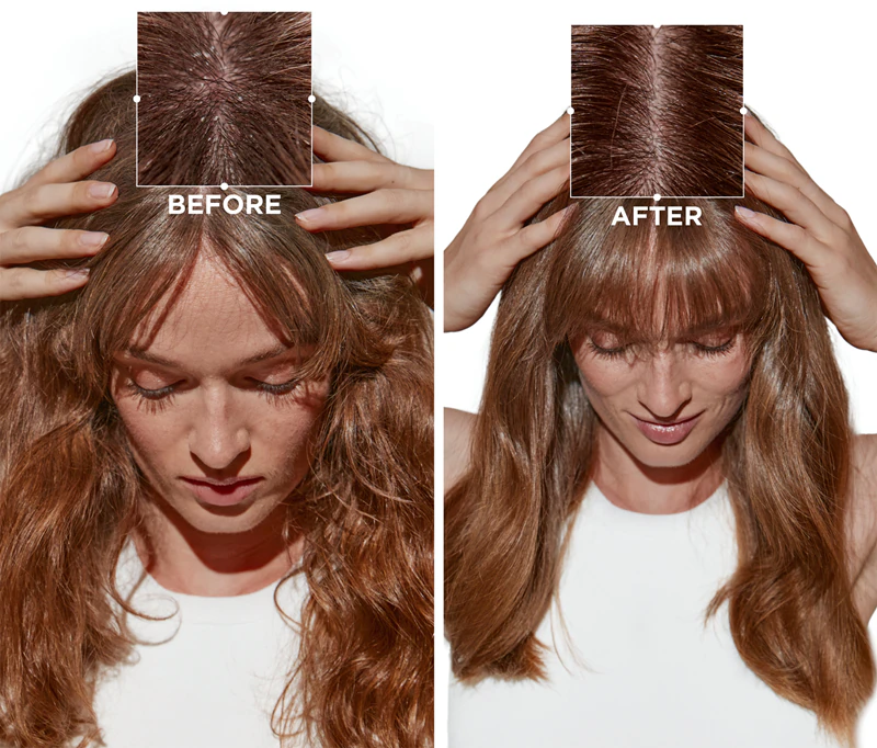 Kérastase Symbiose Bain Crème Anti-Pelliculaire shampoo anticaspa para pele sensível