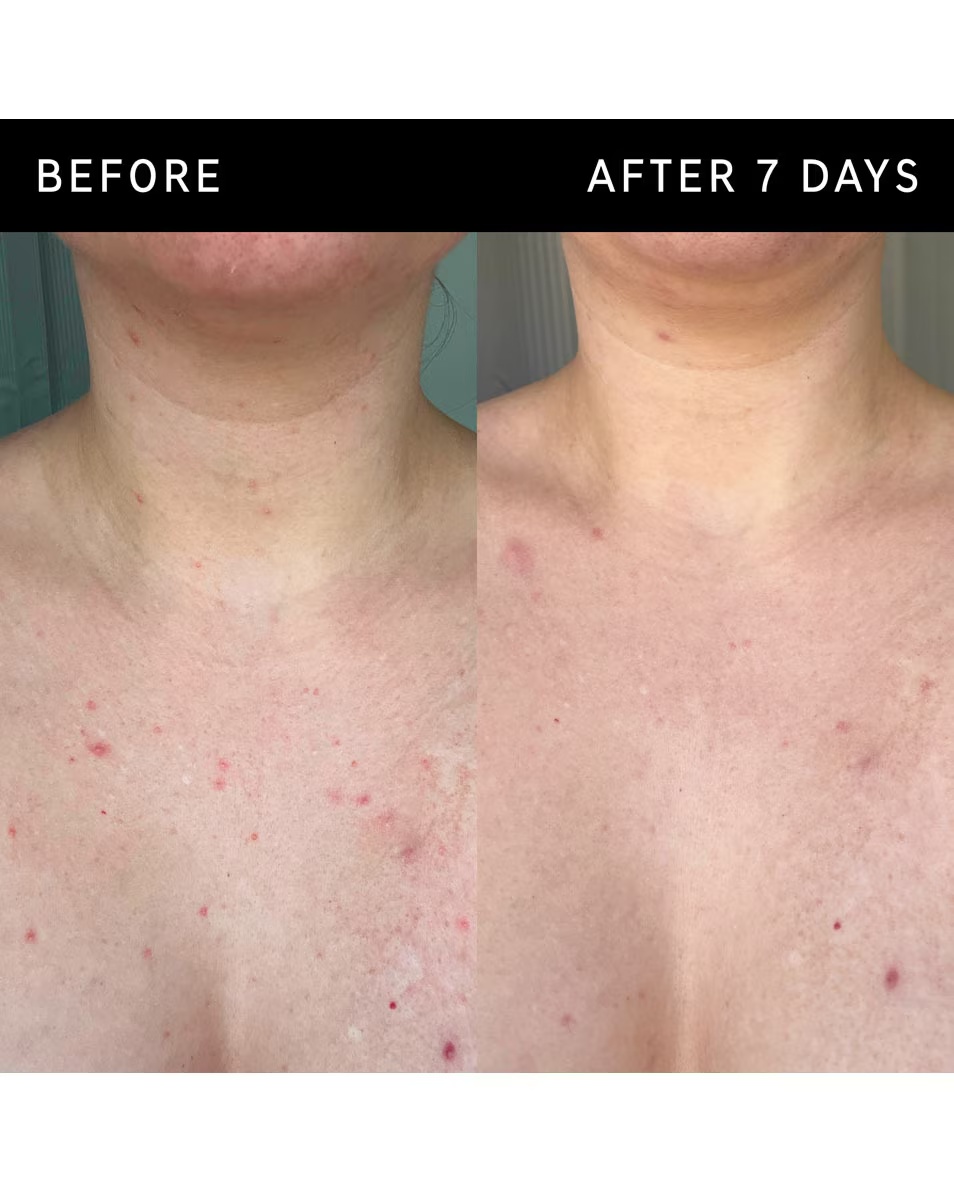 Απολεπιστικό στικ σώματος The Inkey List Body Care με γλυκολικό οξύ