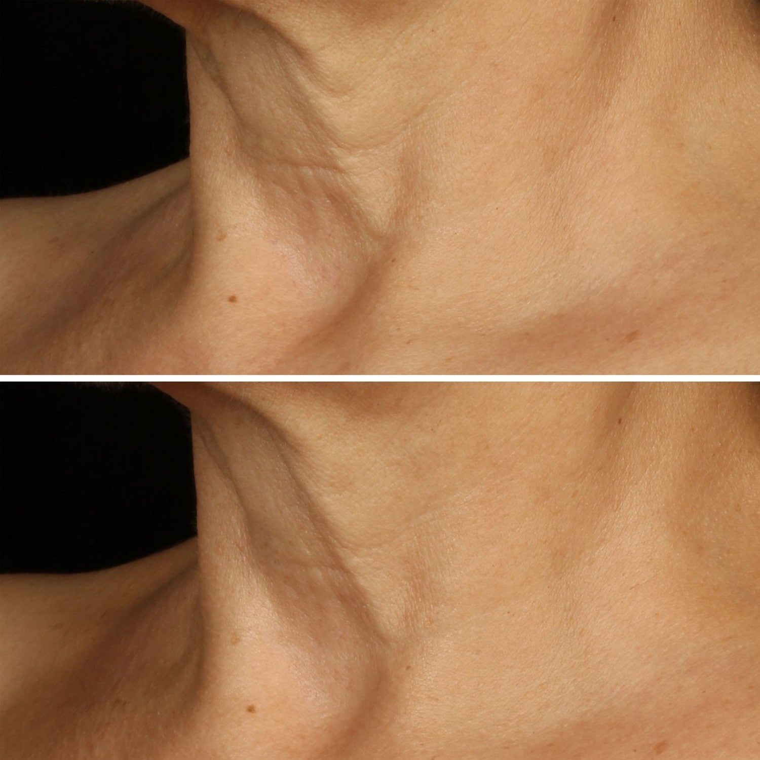 Clinique Crème Liftante Visage + Cou