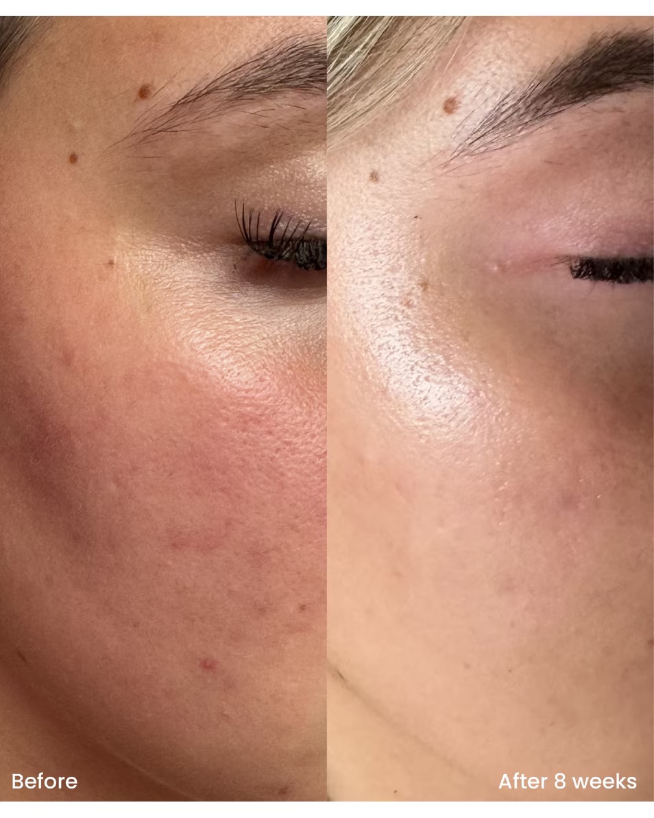 CLAY AND GLOW Serum s niacinamidom 10% Serum za tretman s niacinamidom