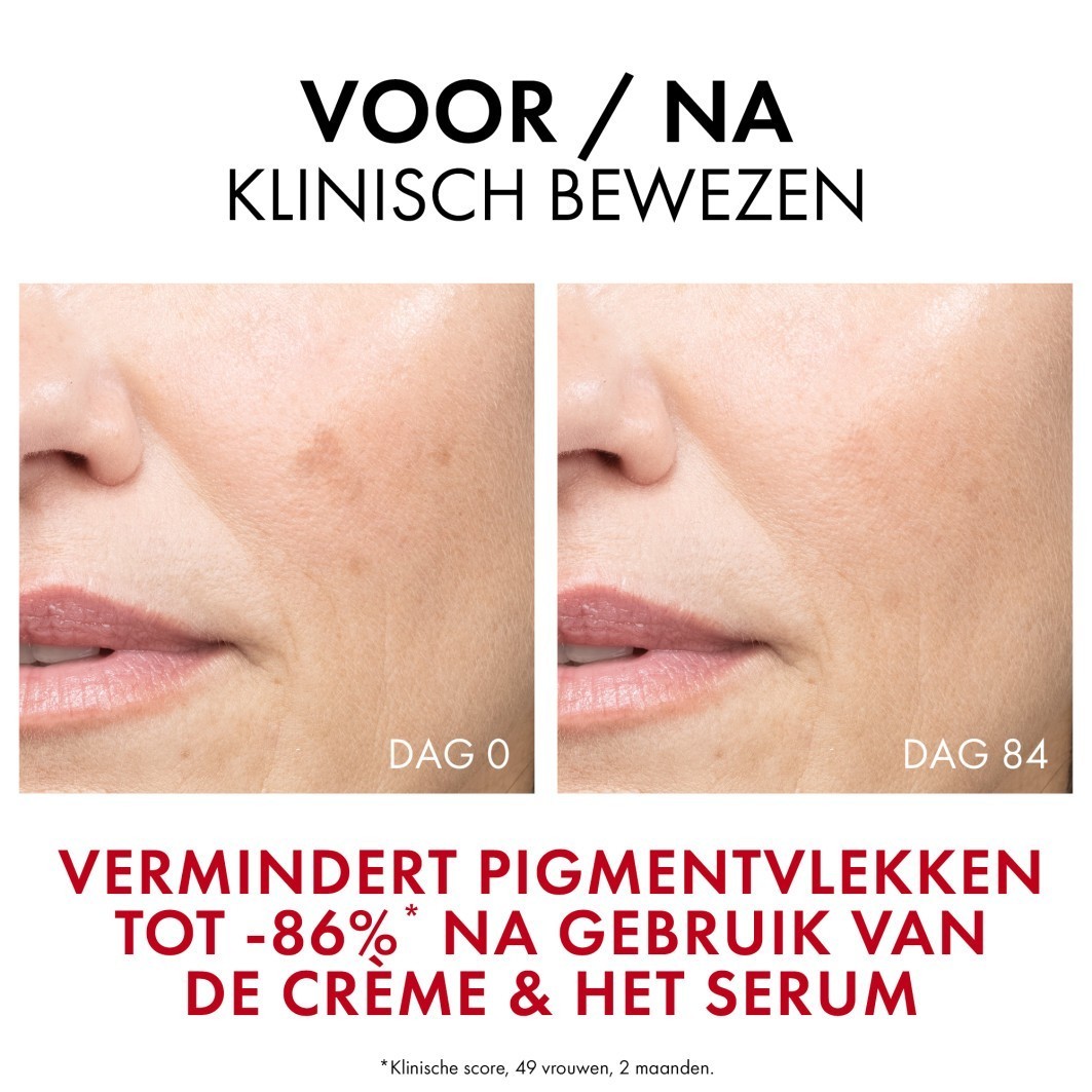 „Vichy“ senėjimą stabdantis serumas „Liftactiv Pigment Specialist B3“ serumas nuo tamsių dėmių – 30 ml