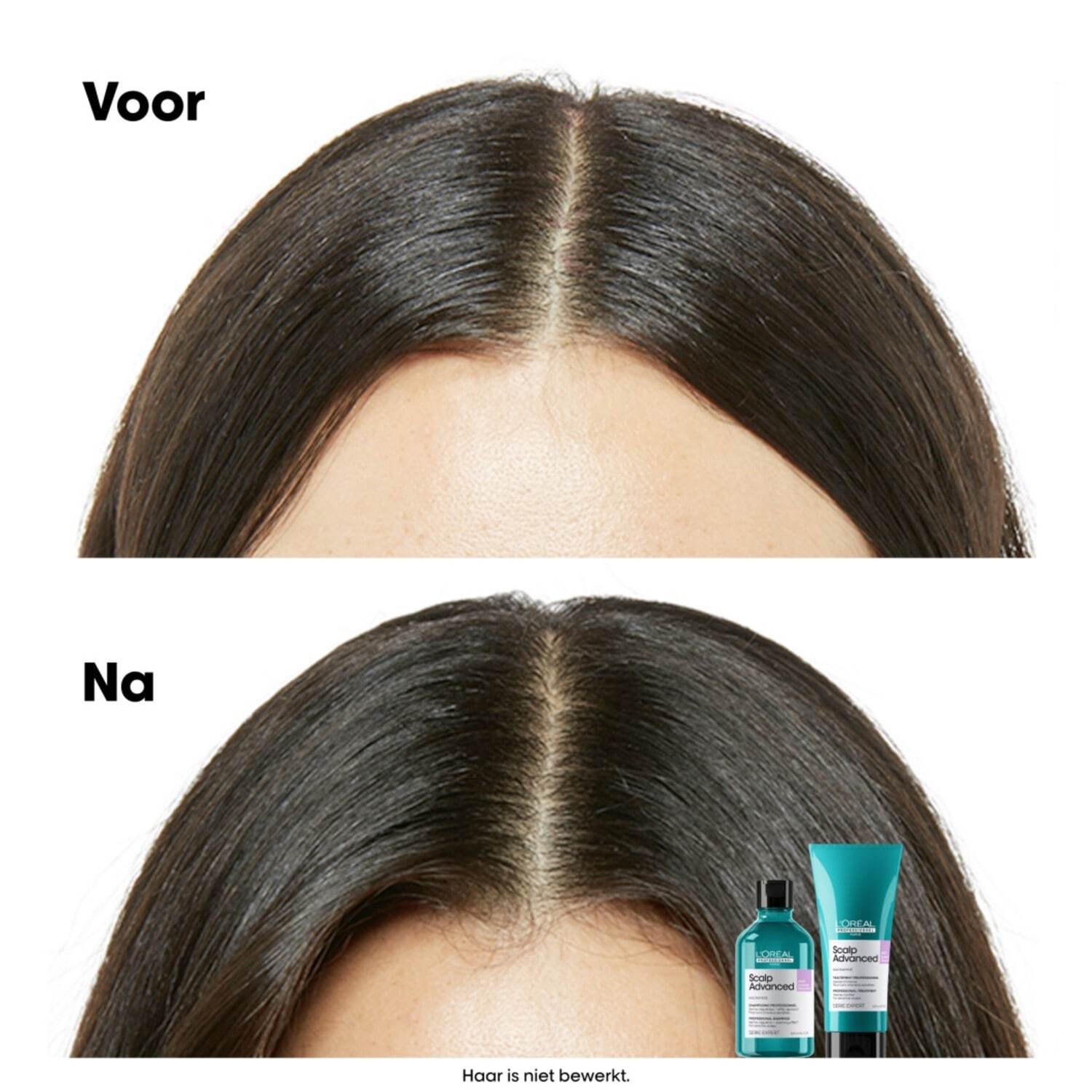 L'Oréal Professionnel šampon za kosu Skalp Advanced Anti-Discomfort Dermo-Regulator - 300 ml