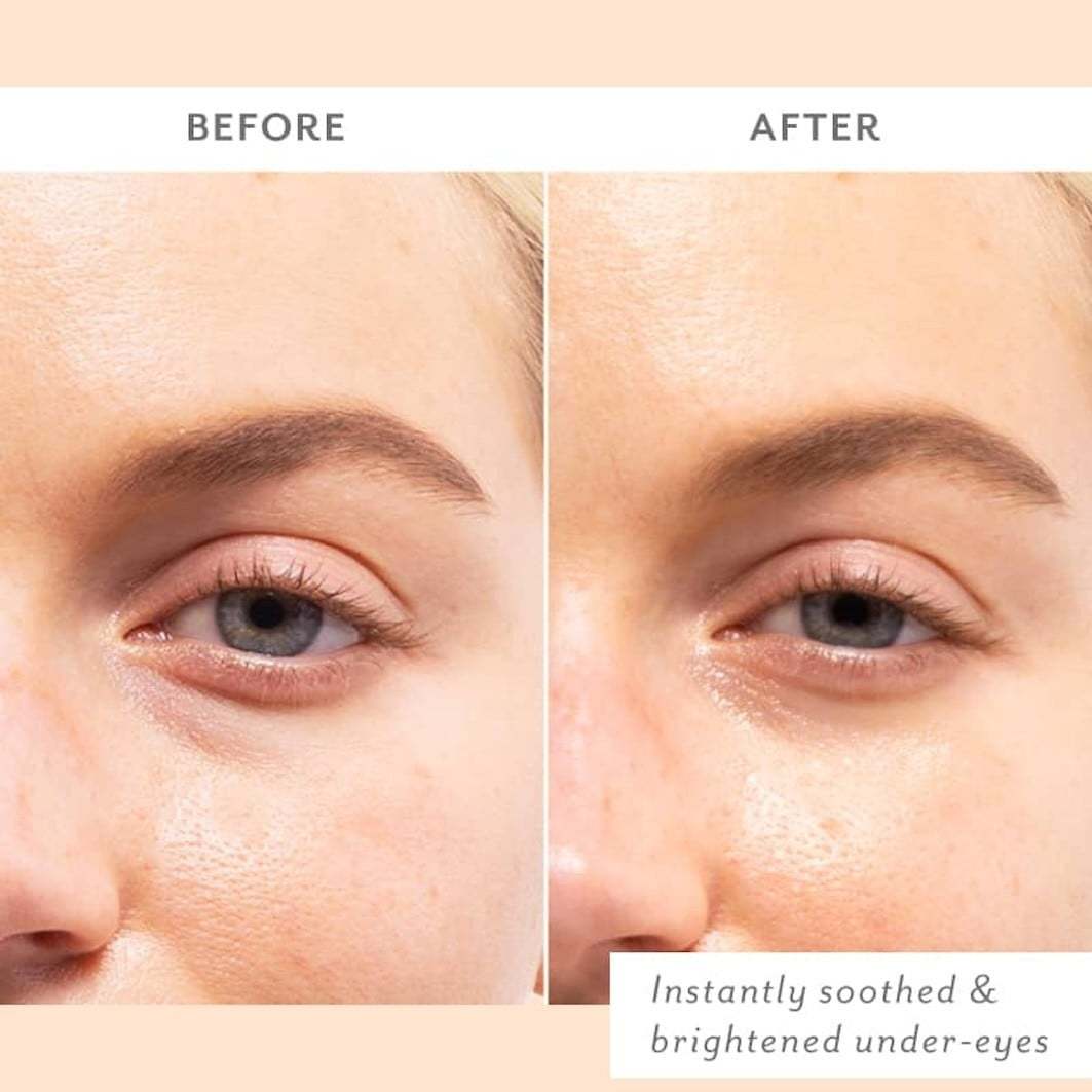 Patchology acu plāksteris Skin Remedy nomierinošs acu gels - 1 gab.