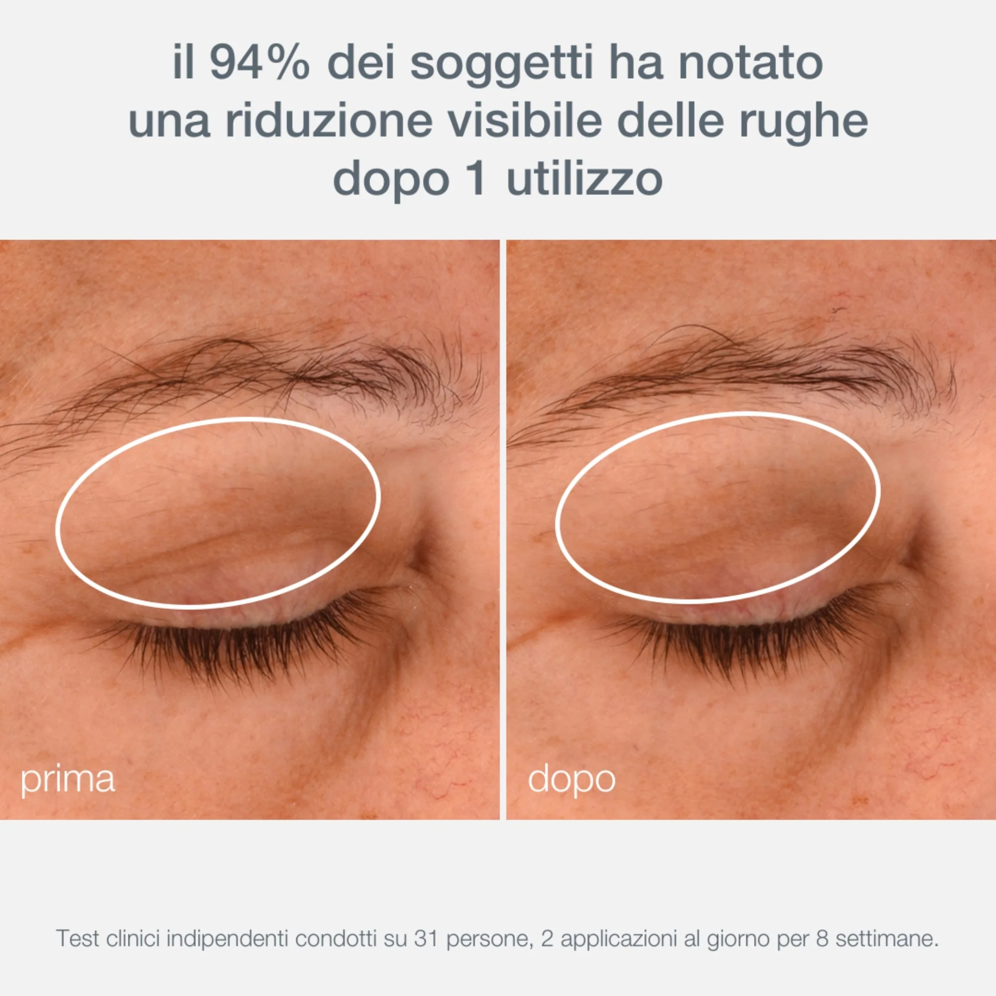 Phyto Nature Phyto Nature Lifting Eye Cream - Contorno occhi antirughe