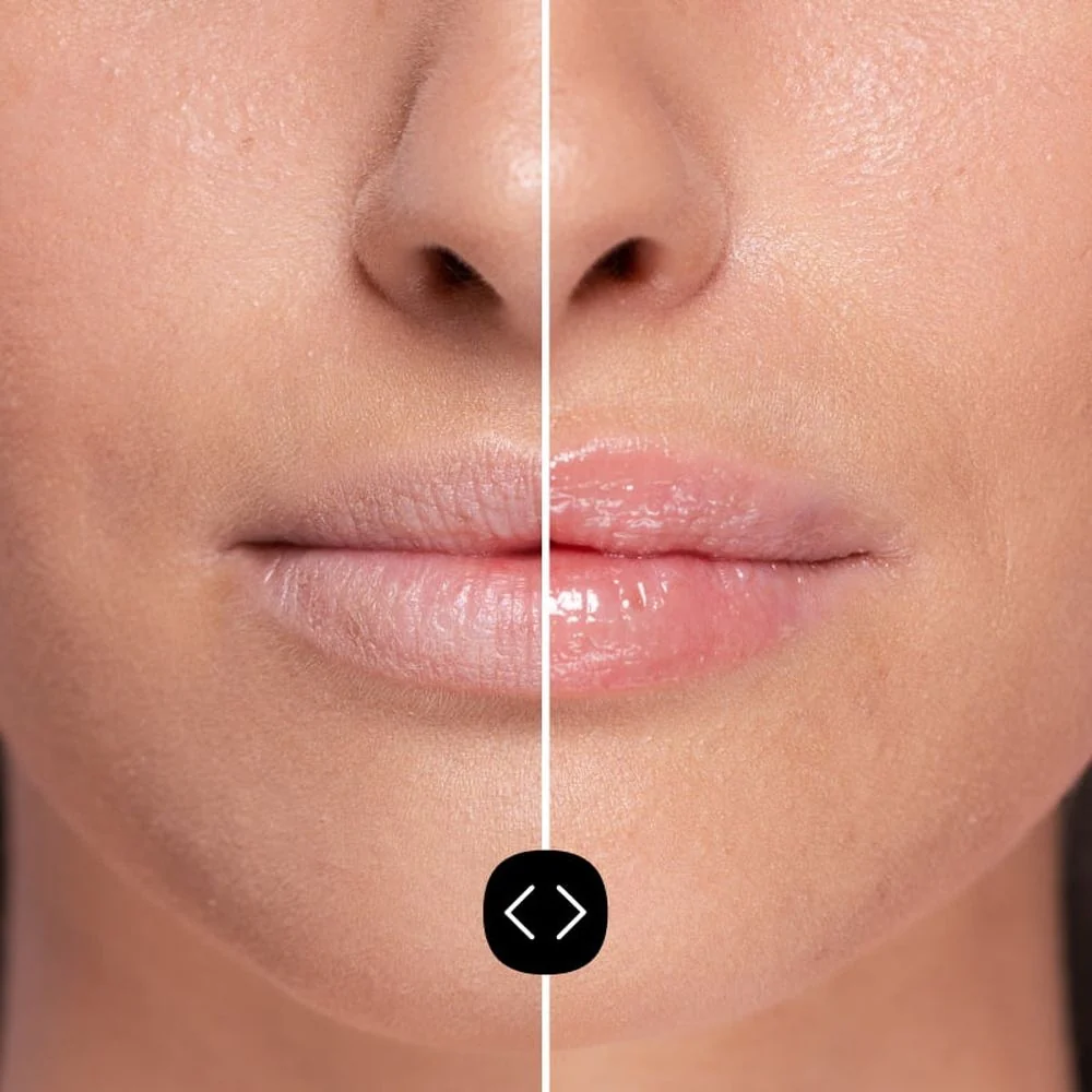 Labbra Hyaluronic Lip Volumiser - Gloss, Volumizzante Labbra