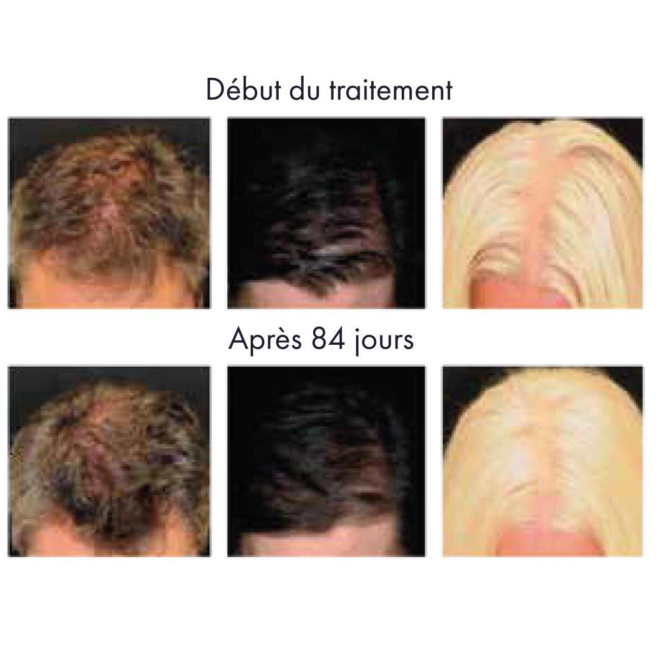 Biokap Lotion renforçante