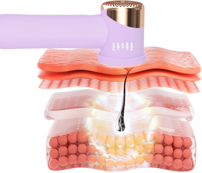 FOREO PEACH™ 2 Go IPL-technologie - preventie van haargroei bij vrouwen