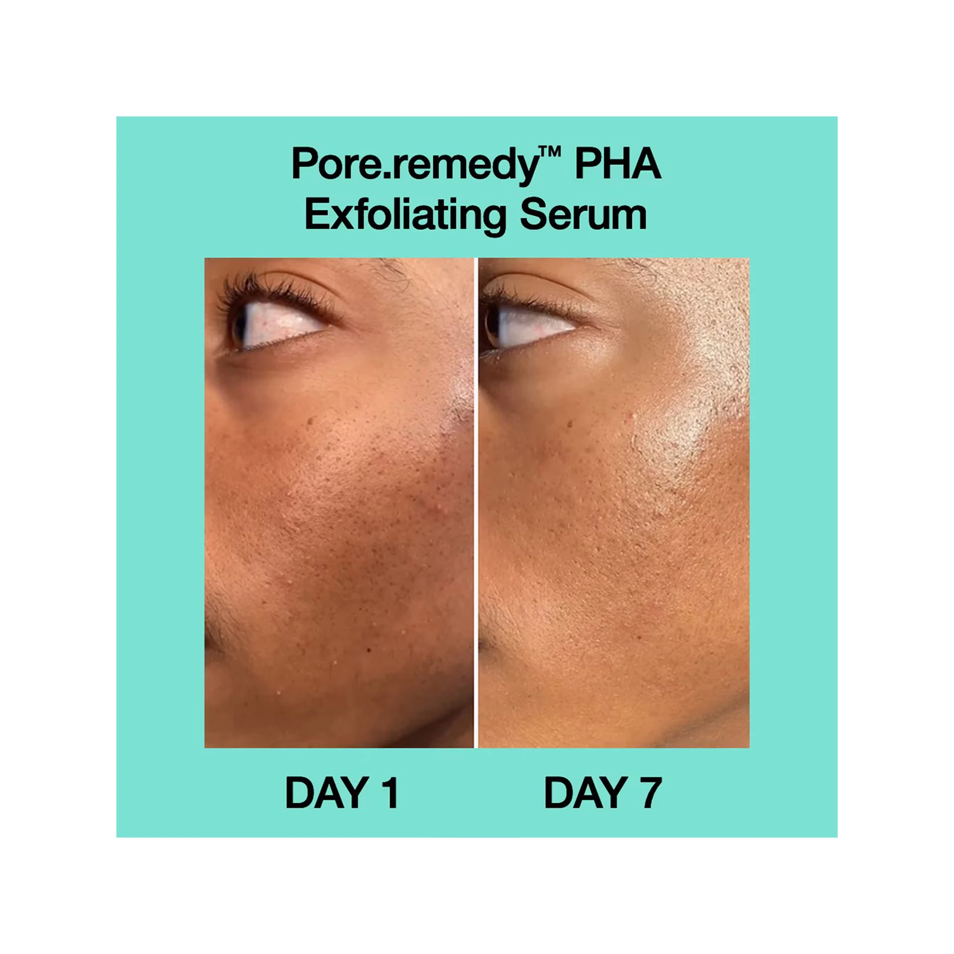 Pore·remedy PHA hámlasztó szérum 30 ml - Dr.Jart+