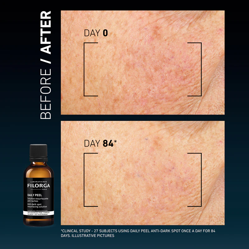FILORGA DAILY PEEL ANTI-DARK SPOT peeling facial contra manchas escuras
