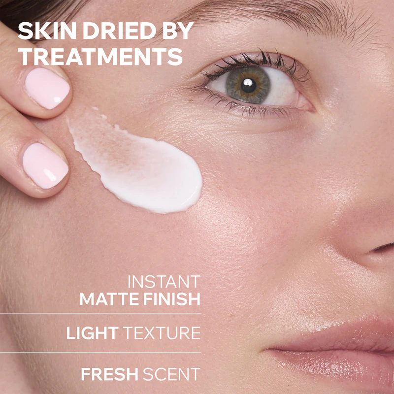 Uriage Hyseac Hydra Soothing Cream je upokojujúci krém pre suchú a podráždenú pokožku spôsobenú liečbou akné.